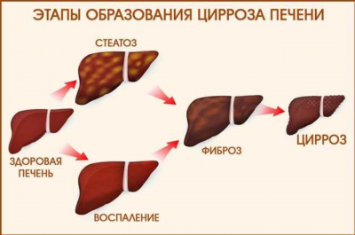 Срок, на который дается группа инвалидности